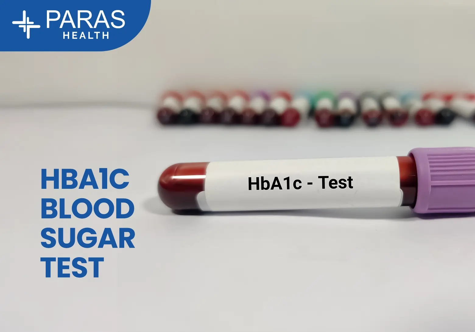 HbA1c Range Level by Age